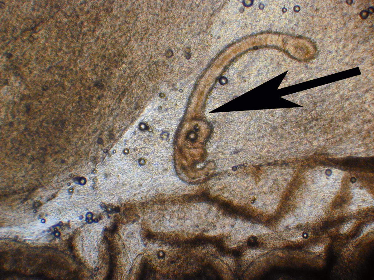Im Verdauungssystem einer Brasse befinden sich Würmer. Foto: Christophe Barla