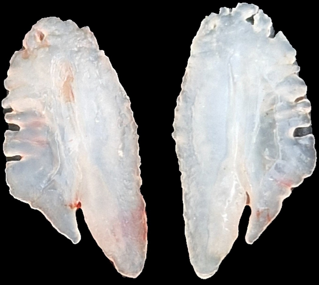 Gehörknöchelchen-Otolithen